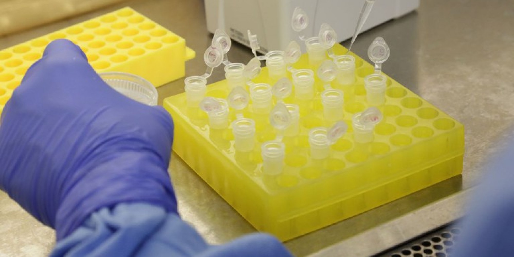 Dos 11 testes aprovados até o momento no Brasil, nove são do tipo rápido, com resultados em cerca de 15 minutos, e dois são do tipo molecular Dos 11 testes aprovados até o momento no Brasil, nove são do tipo rápido, com resultados em cerca de 15 minutos, e dois são do tipo molecular