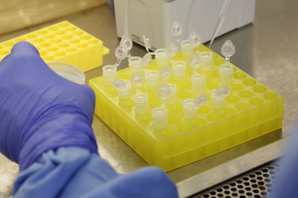 Dos 11 testes aprovados até o momento no Brasil, nove são do tipo rápido, com resultados em cerca de 15 minutos, e dois são do tipo molecular