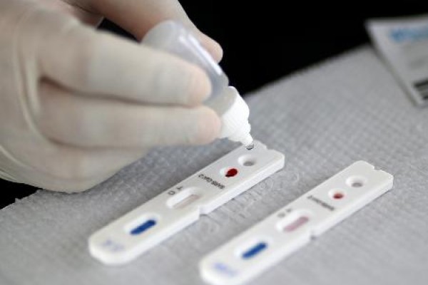 Medida passará a valer a partir da publicação de resolução normativa no Diário Oficial da União.