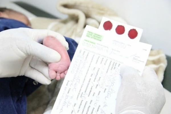 A partir deste ano, todos os recém-nascidos devem ser submetidos ao exame de toxoplasmose congênita SUS